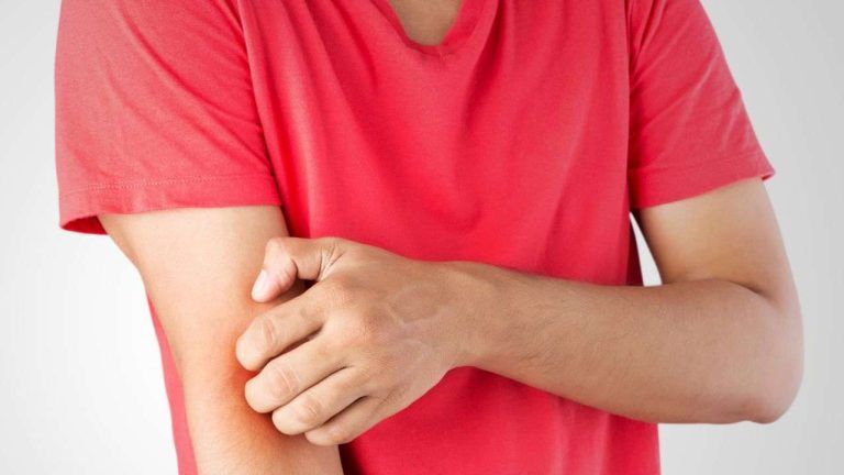 Acari della polvere, come rimuoverli senza fatica: fallo subito, è per il tuo bene Acari della polvere, come rimuoverli senza fatica: fallo subito, è per il tuo bene