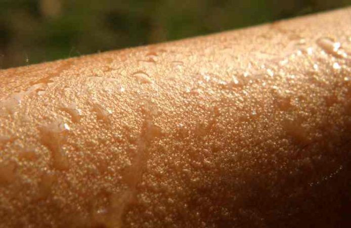 Iperidrosi, cosa scatena la sudorazione patologica