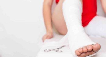 Tibia e perone fratturati: forse non conosci i tempi di recupero
