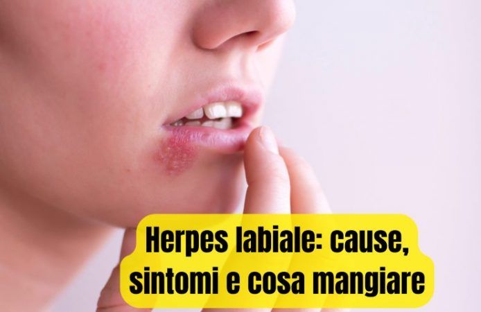 herpes labiale cause cosa mangiare sintomi