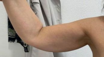 Addio braccia a tendina, prova questo workout: risultati fenomenali