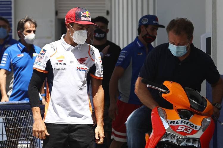 MotoGP | Marquez e il braccio rotto dopo l'operazione - FOTO