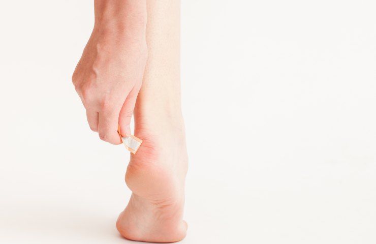 vesciche piedi cause prevenzione rimedi